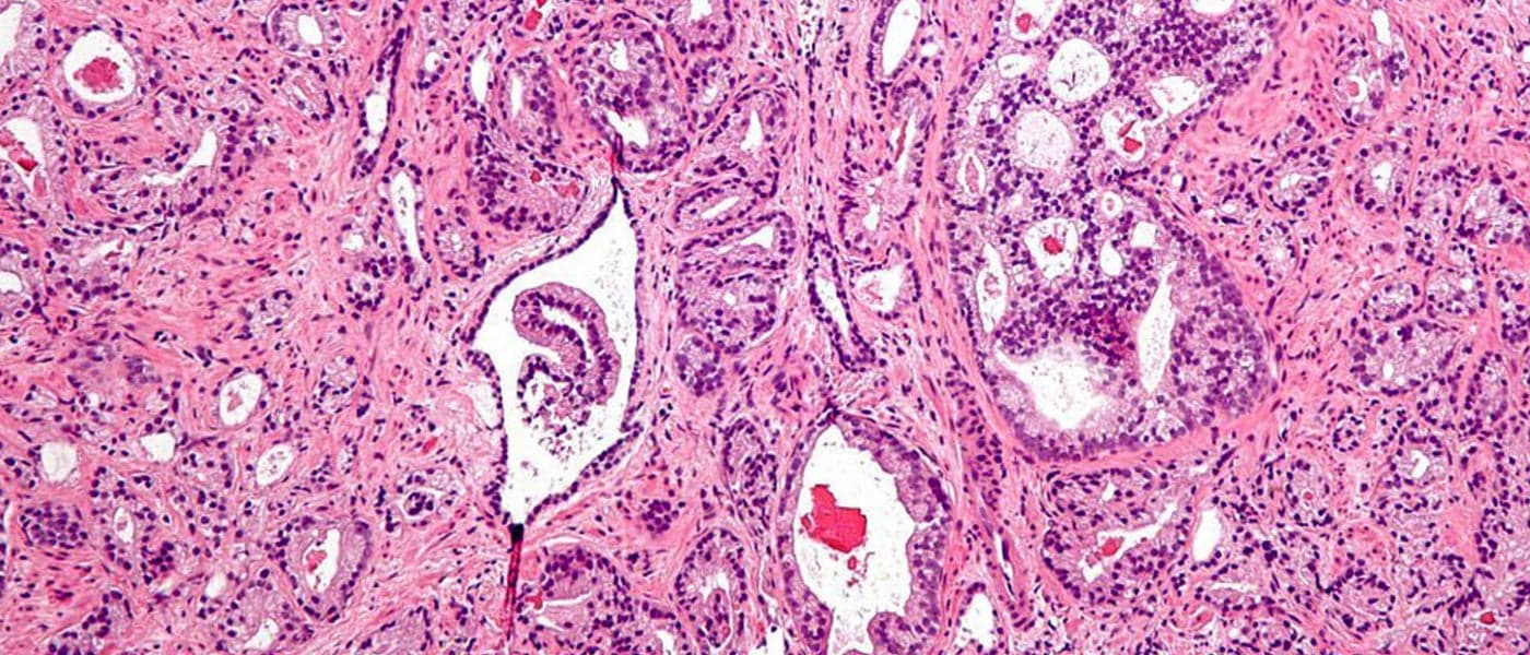 Nephron/Wikimedia